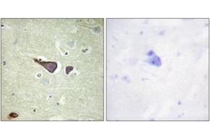 Immunohistochemistry analysis of paraffin-embedded human brain tissue, using IGF2R (Ab-2409) Antibody. (IGF2R antibody  (AA 2381-2430))