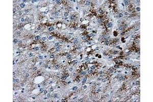 Image no. 9 for anti-Lipase, Endothelial (LIPG) antibody (ABIN1499163)