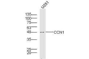 U251 lysates probed with Cry61 Polyclonal Antibody, Unconjugated  at 1:300 overnight at 4˚C. (CYR61 antibody  (AA 251-379))