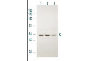 Western blot using Rockland's Affinity Purified anti-GSK3A antibody shows detection of a 52 kDa band corresponding to human GSK3A in various human derived 293T cell extracts.