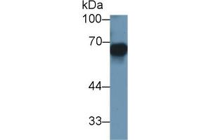 Detection of MMP3 in Human SGC7901 cell lysate using Monoclonal Antibody to Matrix Metalloproteinase 3 (MMP3) (MMP3 antibody  (AA 363-477))