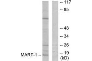 Western blot analysis of extracts from NIH-3T3 cells, using MART-1 Antibody. (MLANA antibody  (AA 41-90))