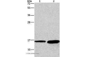 Western blot analysis of Mouse heart and human hepatocellular carcinoma tissue, using HINT2 Polyclonal Antibody at dilution of 1:300