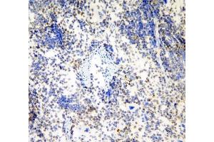 IHC analysis of HP1 gamma using anti-HP1 gamma antibody (ABIN5693033). (CBX3 antibody  (AA 2-183))