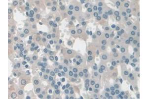 IHC-P analysis of Rat Adrenal gland Tissue, with DAB staining. (COQ6 antibody  (AA 1-476))