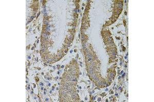 Immunohistochemistry of paraffin-embedded human stomach using MTIF3 antibody.