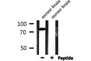 Western blot analysis of extracts from mouse brain, using ATF6B Antibody. (ATF6B antibody  (Internal Region))