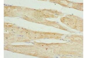Immunohistochemistry of paraffin-embedded human skeletal muscle tissue using ABIN7173557 at dilution of 1:100 (Tropomodulin 4 antibody  (AA 1-345))