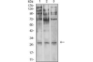 Western Blotting (WB) image for anti-Elastase, Neutrophil Expressed (ELANE) (AA 140-267) antibody (ABIN5611333)