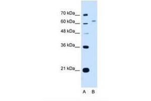 Image no. 1 for anti-WSC Domain Containing 2 (WSCD2) (C-Term) antibody (ABIN341313) (WSCD2 antibody  (C-Term))