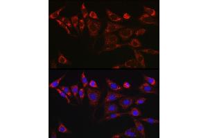 Immunofluorescence analysis of NIH/3T3 cells using KITLG Rabbit pAb (ABIN6128159, ABIN6142901, ABIN6142902 and ABIN6221323) at dilution of 1:25 (40x lens). (KIT Ligand antibody  (AA 26-214))