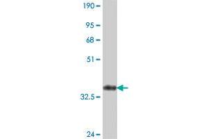 Western Blot detection against Immunogen (37 KDa) . (CDC42BPB antibody  (AA 1580-1679))