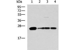 Western blot analysis of 293T LO2 and HepG2 cell lysates using MMAB Polyclonal Antibody at dilution of 1:1400 (MMAB antibody)