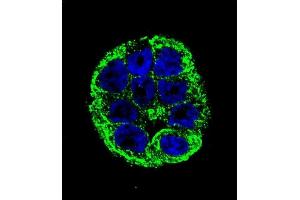 Confocal immunofluorescent analysis of YOD1 Antibody (C-term) (ABIN655251 and ABIN2844850) with WiDr cell followed by Alexa Fluor 488-conjugated goat anti-rabbit lgG (green). (YOD1 antibody  (C-Term))