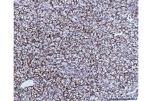 IHC analysis of GLUD1/2 using anti-GLUD1/2 antibody (ABIN7602000). (GLUD1 / GLUD2 (AA 54-553) antibody)