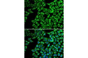 Immunofluorescence analysis of  cells using LIPC antibody (ABIN6131783, ABIN6143250, ABIN6143251 and ABIN6217533). (LIPC antibody  (AA 280-499))