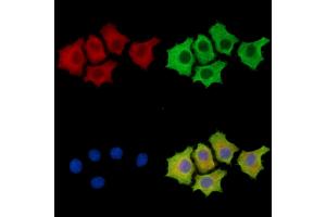 anti-RAB GTPase Activating Protein 1 (RABGAP1) antibody