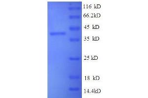 SDS-PAGE (SDS) image for HLA Class I Histocompatibility Antigen, alpha Chain G (HLAG) (AA 25-337), (partial) protein (GST tag) (ABIN1047176)