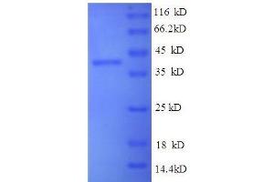 HLA Class I Histocompatibility Antigen, alpha Chain G (HLAG) (AA 25-337), (partial) protein (GST tag)