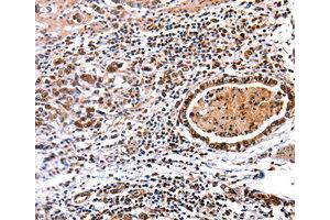 Immunohistochemistry (IHC) image for anti-DNA (Cytosine-5-)-Methyltransferase 3 alpha (DNMT3A) antibody (ABIN1872325) (DNMT3A antibody)