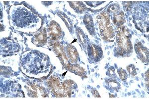 Human kidney; FOXF1 antibody - C-terminal region in Human kidney cells using Immunohistochemistry (FOXF1 antibody  (C-Term))