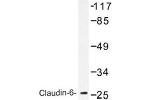 Image no. 2 for anti-Claudin 6 (CLDN6) antibody (ABIN317829) (Claudin 6 antibody)