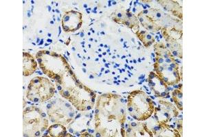 Immunohistochemistry of paraffin-embedded Mouse kidney using COMT Polyclonal Antibody at dilution of 1:100 (40x lens).