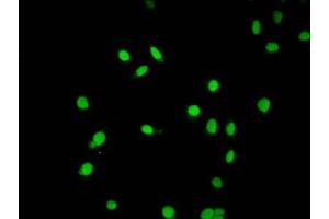 Immunofluorescence staining of Hela cells (treated with 30mM sodium butyrate for 4h) with ABIN7139203 at 1:5, counter-stained with DAPI. (HIST1H2AG antibody  (acLys9))