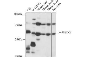 Western blot analysis of extracts of various cell lines, using PNLDC1 antibody (ABIN7269447) at 1:1000 dilution. (PNLDC1 antibody  (AA 200-500))
