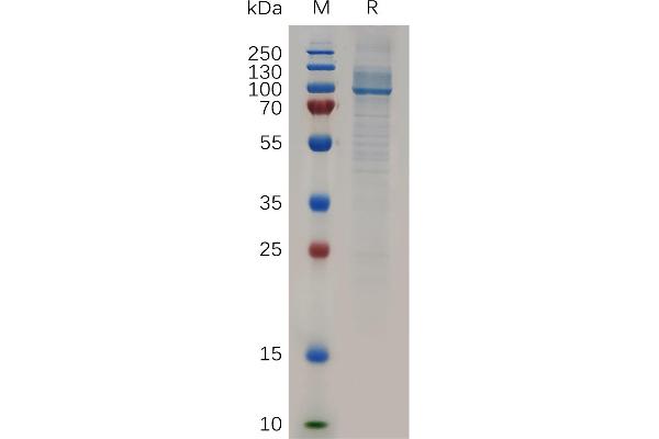 HSP90AA1 Protein (AA 2-732) (His tag)