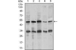 Western blot analysis using CHGA mouse mAb against MOLT4 (1), SK-N-SH (2), HepG2 (3), PC-12 (4), and C6 (5) cell lysate. (Chromogranin A antibody  (AA 87-252))