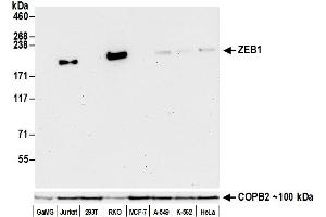 Western Blotting (WB) image for anti-Zinc Finger E-Box Binding Homeobox 1 (ZEB1) (C-Term) antibody (ABIN7795625) (Recombinant ZEB1 antibody  (C-Term))