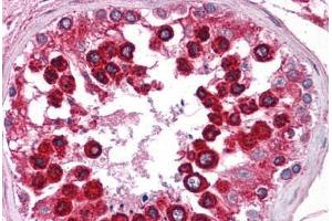 Human Testis: Formalin-Fixed, Paraffin-Embedded (FFPE) (Calnexin antibody  (AA 109-274))