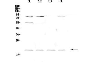 Western blot analysis of CD59 using anti-CD59 antibody .