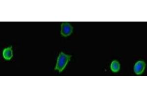 Immunofluorescent analysis of MCF-7 cells using ABIN7173921 at dilution of 1:100 and Alexa Fluor 488-congugated AffiniPure Goat Anti-Rabbit IgG(H+L) (TP53INP2 antibody  (AA 100-220))