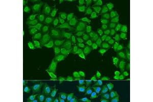 Immunofluorescence analysis of U2OS cells using ATP5O Polyclonal Antibody at dilution of 1:100. (ATP5O antibody)