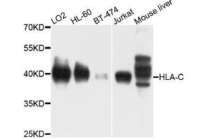Western blot analysis of extracts of various cell lines, using HLA-C antibody (ABIN4903930) at 1:1000 dilution. (HLA-C antibody)
