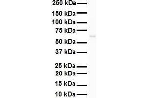 WB Suggested Anti-SNRP70 antibody Titration: 1 ug/mL Sample Type: HEK293 (SNRNP70 antibody  (N-Term))