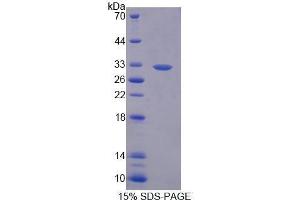 SDS-PAGE (SDS) image for Breast Cancer 2, Early Onset (BRCA2) (AA 2308-2537) protein (His tag) (ABIN2124174)