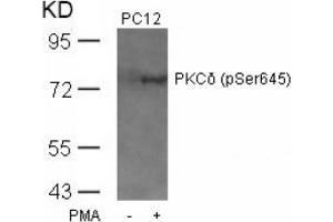 Image no. 2 for anti-Protein Kinase C, delta (PKCd) (pSer645) antibody (ABIN197068) (PKC delta antibody  (pSer645))