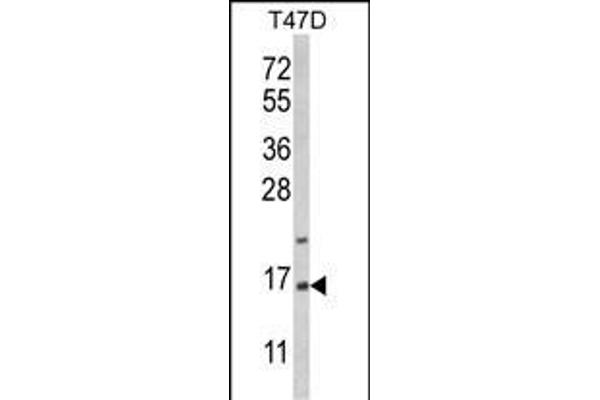 PEA15 Antikörper  (C-Term)