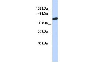 PIWIL4 antibody used at 1 ug/ml to detect target protein.