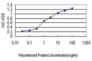 Detection limit for recombinant GST tagged CRX is approximately 0. (CRX antibody  (AA 1-95))