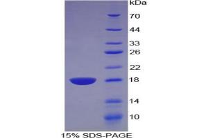 SDS-PAGE analysis of Rat Artemin Protein.