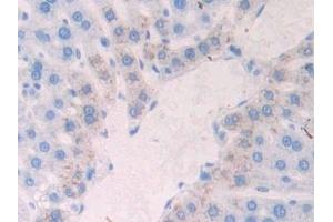 Detection of NCAD in Rat Liver Tissue using Polyclonal Antibody to N-cadherin (NCAD) (N-Cadherin antibody  (AA 295-414))