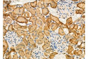 ABIN6263554 and ABIN6277124 at 1/100 staining Rat kidney tissue by IHC-P. (NDRG1 antibody  (C-Term))
