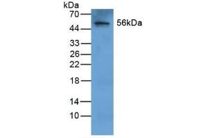 Detection of FGB in Human Liver Tissue using Polyclonal Antibody to Fibrinogen Beta Chain (FGB) (Fibrinogen beta Chain antibody  (AA 29-491))