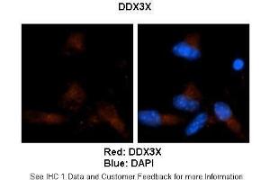 Sample Type :  Human brain stem cells (NT2)   Primary Antibody Dilution :   1:500  Secondary Antibody :  Goat anti-rabbit Alexa Fluor 594  Secondary Antibody Dilution :   1:1000  Color/Signal Descriptions :  Red: DDX3X Blue: DAPI  Gene Name :  DDX3X  Submitted by :  Dr. (DDX3X antibody  (N-Term))