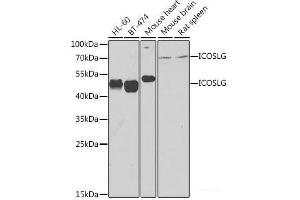 Western blot analysis of extracts of various cell lines using ICOSL Polyclonal Antibody at dilution of 1:1000. (ICOSLG antibody)