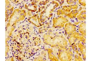 Immunohistochemistry of paraffin-embedded human kidney tissue using ABIN7150914 at dilution of 1:100 (Dysferlin antibody  (AA 105-278))